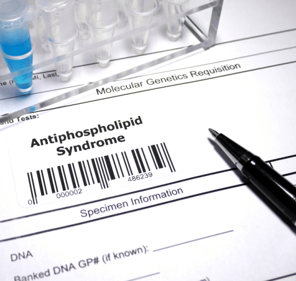 picture showing test tubes and a diagnosis of antiphospholipid syndrome.