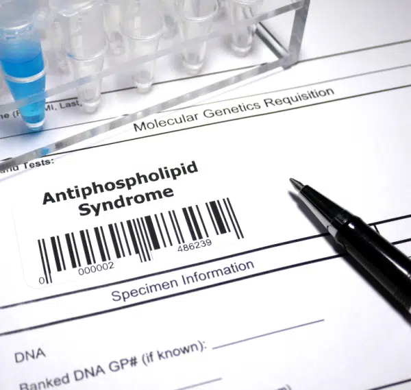 picture showing test tubes and a diagnosis of antiphospholipid syndrome.