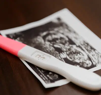 pregnancy test and sonogram picture of developing baby