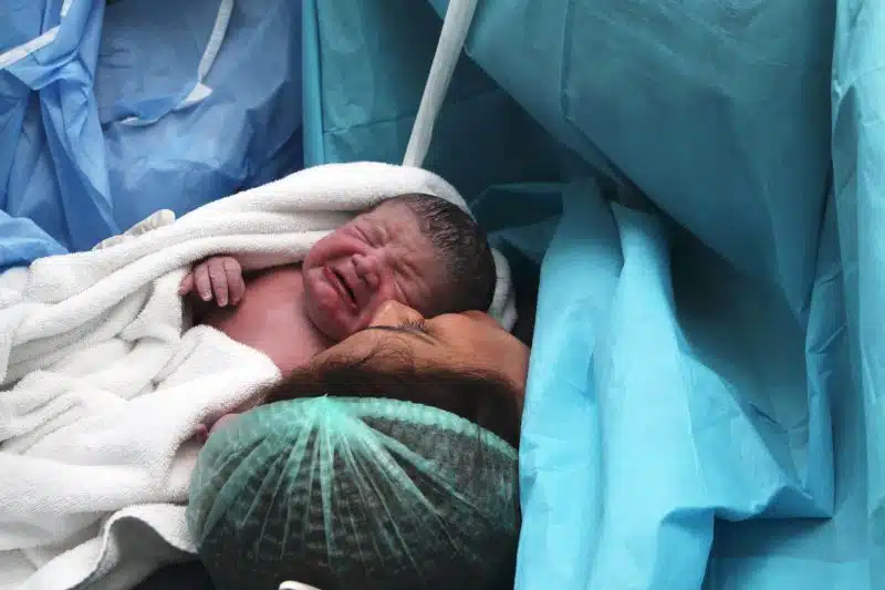 newborn after c-section